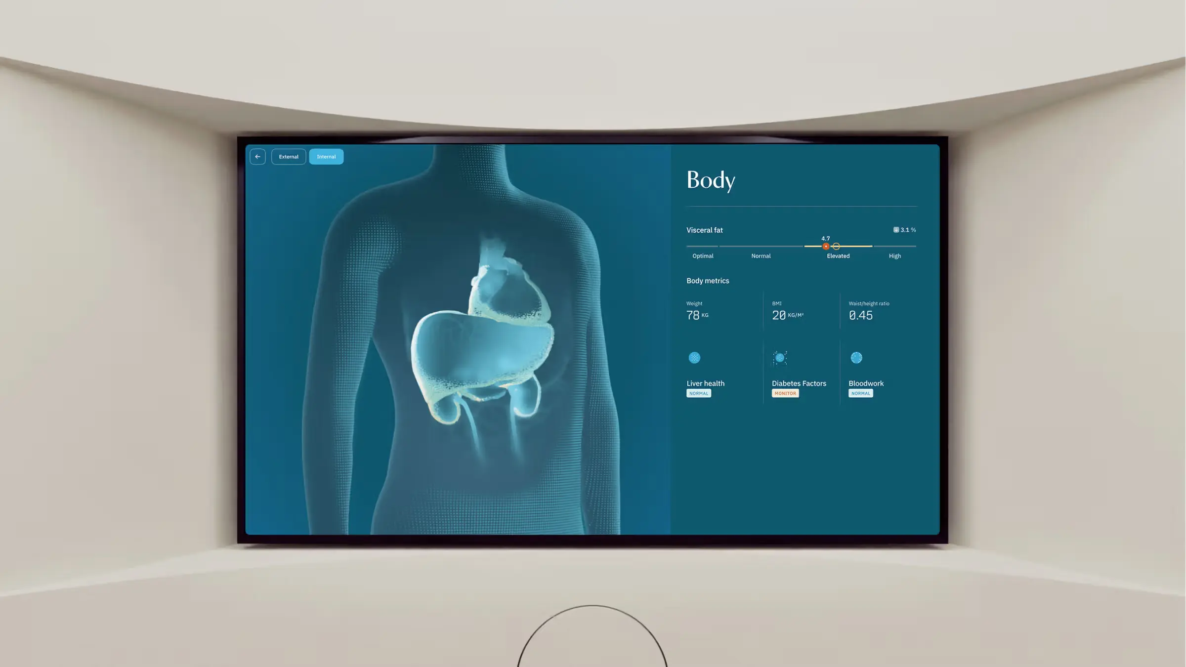 Medical scan display showing body-composition metrics and an anatomical visualization